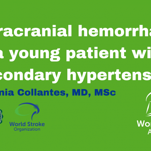 Case Study – Intracranial hemorrhage in a young patient with secondary hypertension