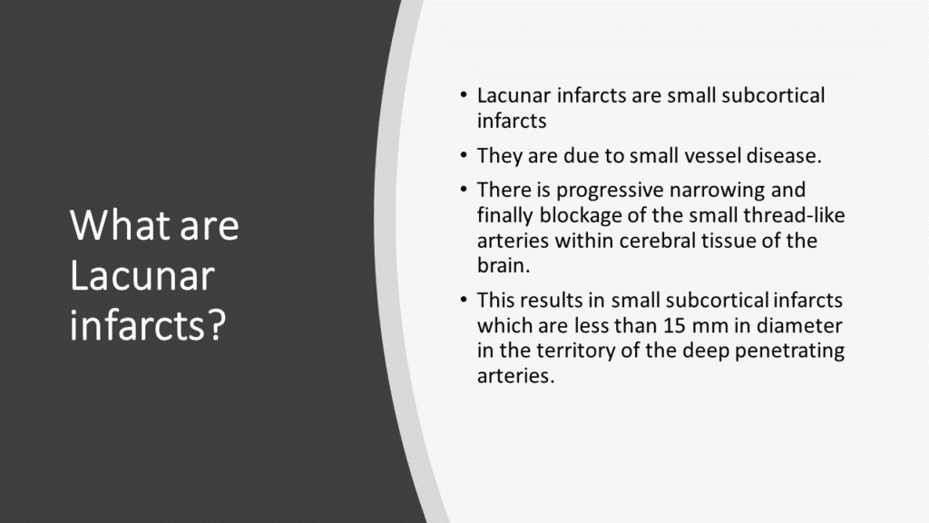 What Is Another Name For Lacunar Stroke