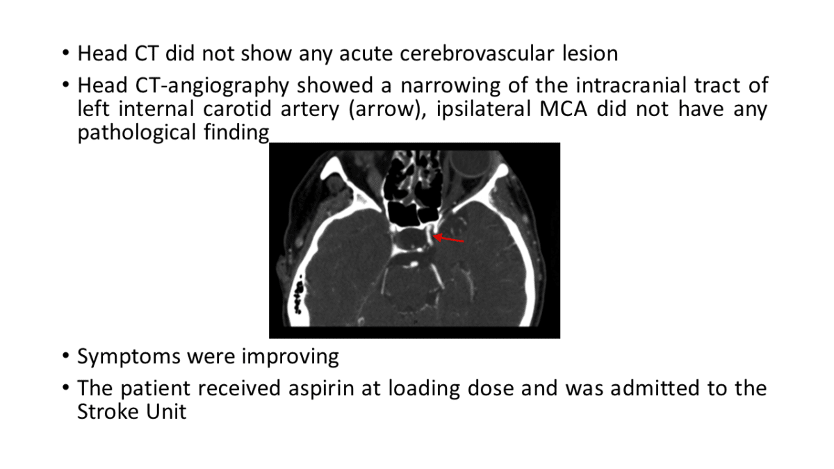 Computed Tomography - World Stroke Academy