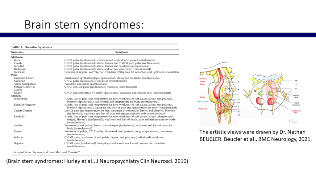 Brain stem syndromes World Stroke Academy