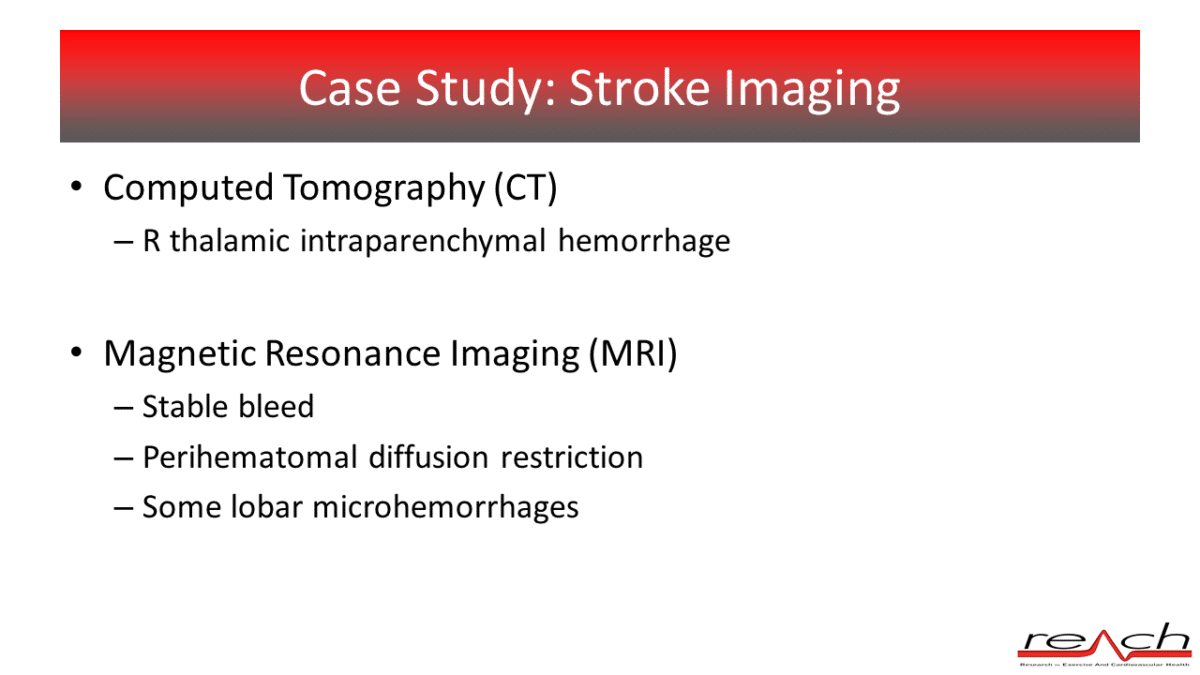 Stroke Imaging - World Stroke Academy