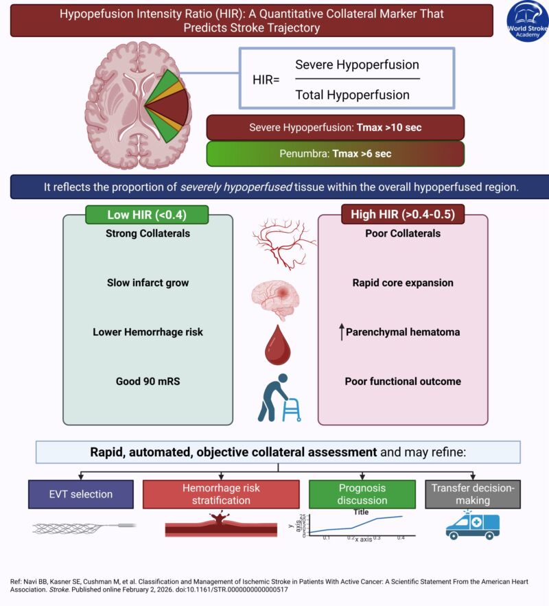 Image for the Tweet beginning: #MondayTip
Hypoperfusion Intensity Ratio 
#HIR may